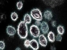 कोरोना वायरस के BA.5 का म्यूटेशन चिंता का विषय क्यों है? WHO ने बताया