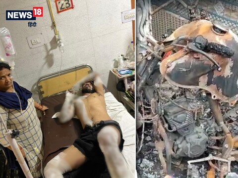 लखनऊ: संदिग्ध परिस्थितियों में आग से झुलसा युवक अस्पताल में भर्ती.