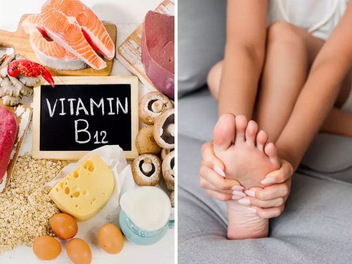 Vitamin B12 vitamin-b12