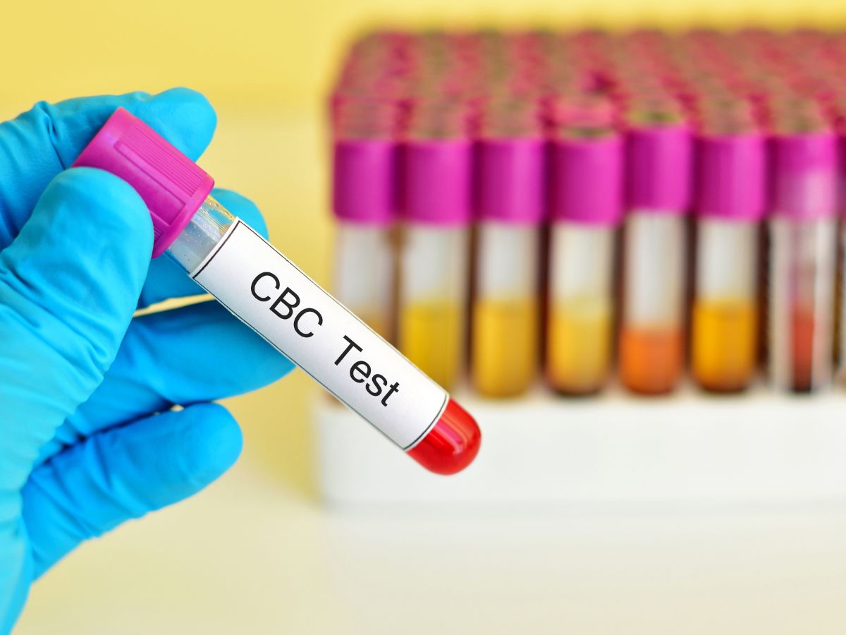 Platelet Count May Increase Due To Stress These Problems May Occur