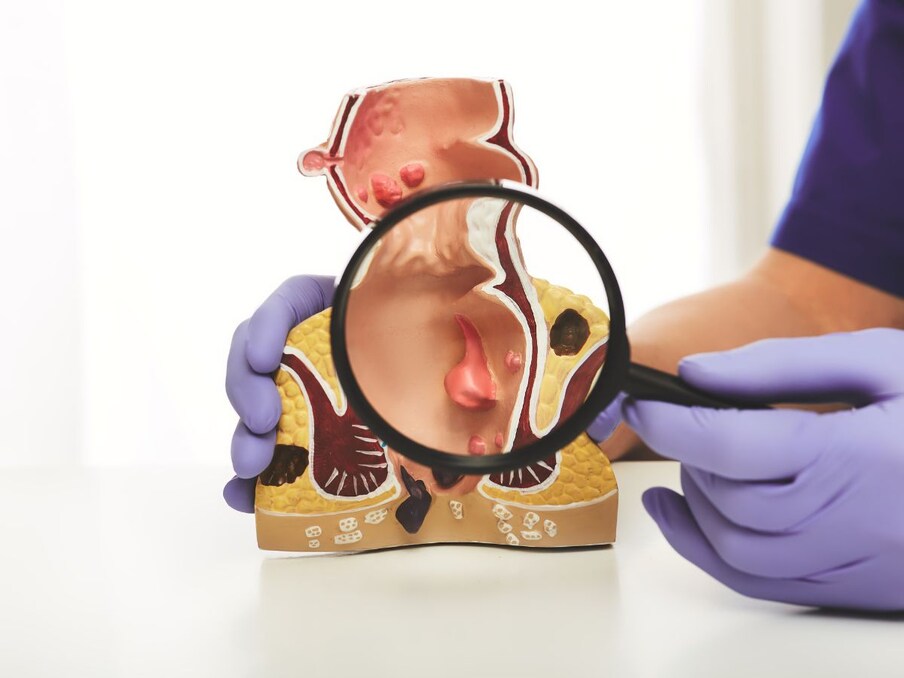  प्रोक्टोलॉजिस्ट (proctologist) वो डॉक्टर होते हैं जो मलाशय की जांच करते हैं. इनको मरीज के मलाशय और उनके मल की जांच करनी पड़ती है. वैसे तो ये डॉक्टर ही हैं मगर काम काफी घिनौना होता है. कई देशों में ये डॉक्टर साल का 3 करोड़ रुपये तक कमा लेते हैं मगर बहुत से लोग उसके बावजूद भी शायद इस काम को नहीं करना चाहेंगे. (प्रतीकात्मक फोटो: Canva)