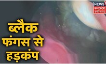 Ambikapur News: Black Fungus के 2 मामले मिलने से हड़कंप, मरीजों का Medical College में इलाज जारी