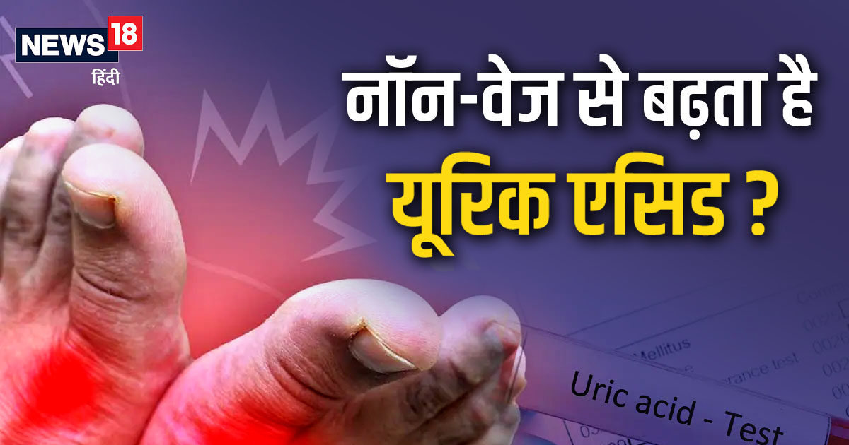 High Uric Acid के ये लक्षण दिखते ही छोड़ दें नॉनवेज, वरना फेल हो जाएगी
