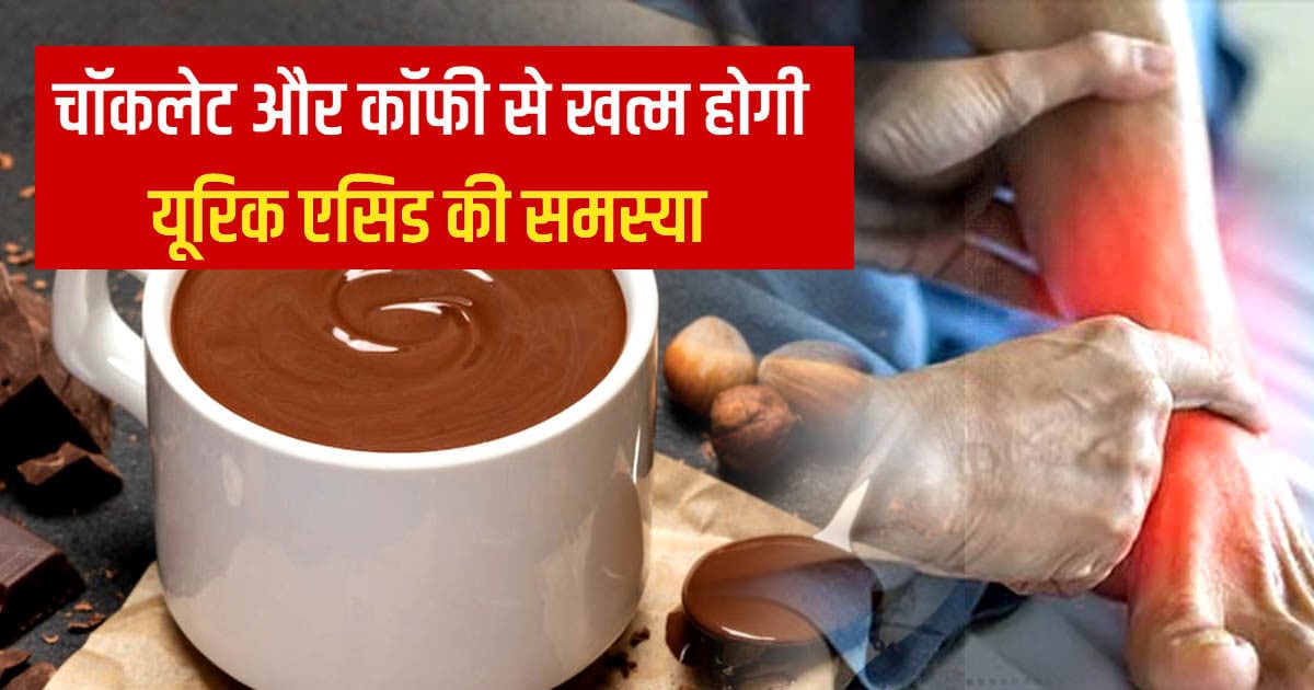घर बैठे खत्म हो जाएगी High Uric Acid की समस्या, एक चॉकलेट और एक कप कॉफी