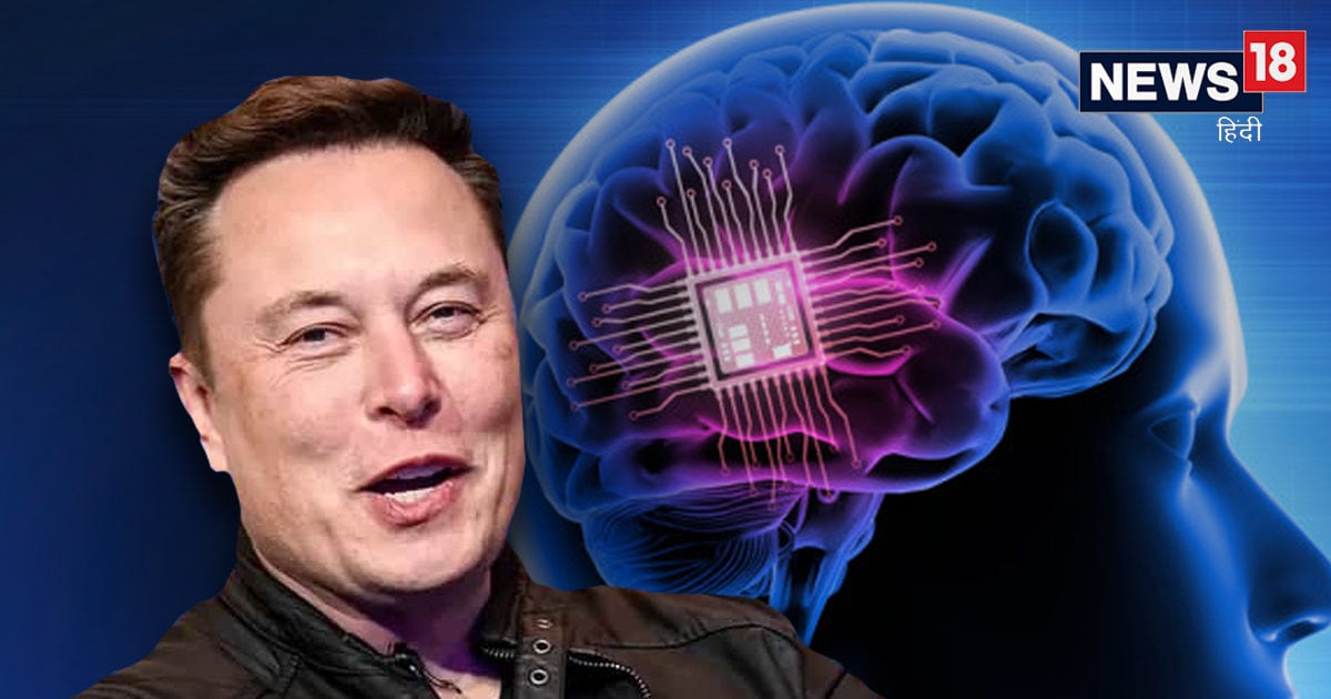 Brain Chip डालकर लोगों को कंट्रोल करना चाहते हैं Elon Musk? जानें कहां