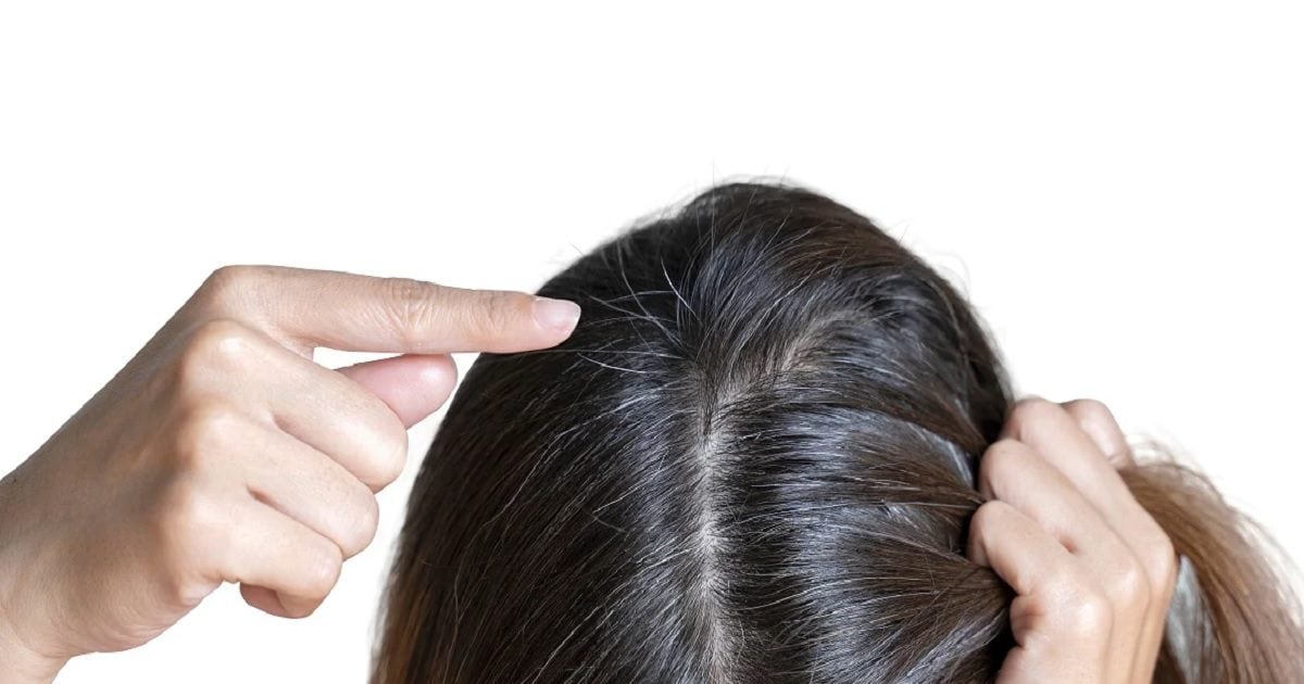 White Hair treatment: क्या कम उम्र में बाल सफेद होने से रोका जा सकता है? अगर करें ये काम तो मुमकिन है - white hair treatment how to reverse grey hair naturally know in hindi – News18 हिंदी White Hair treatment: क्या कम उम्र में बाल सफेद होने से रोका जा सकता है? अगर करें ये काम तो मुमकिन है - white hair treatment how to reverse grey hair naturally know in hindi – News18 हिंदी