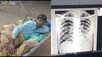 इस जानलेवा बीमारी का नहीं कोई इलाज, राजस्थान में हैं इसके सैकड़ों मरीज