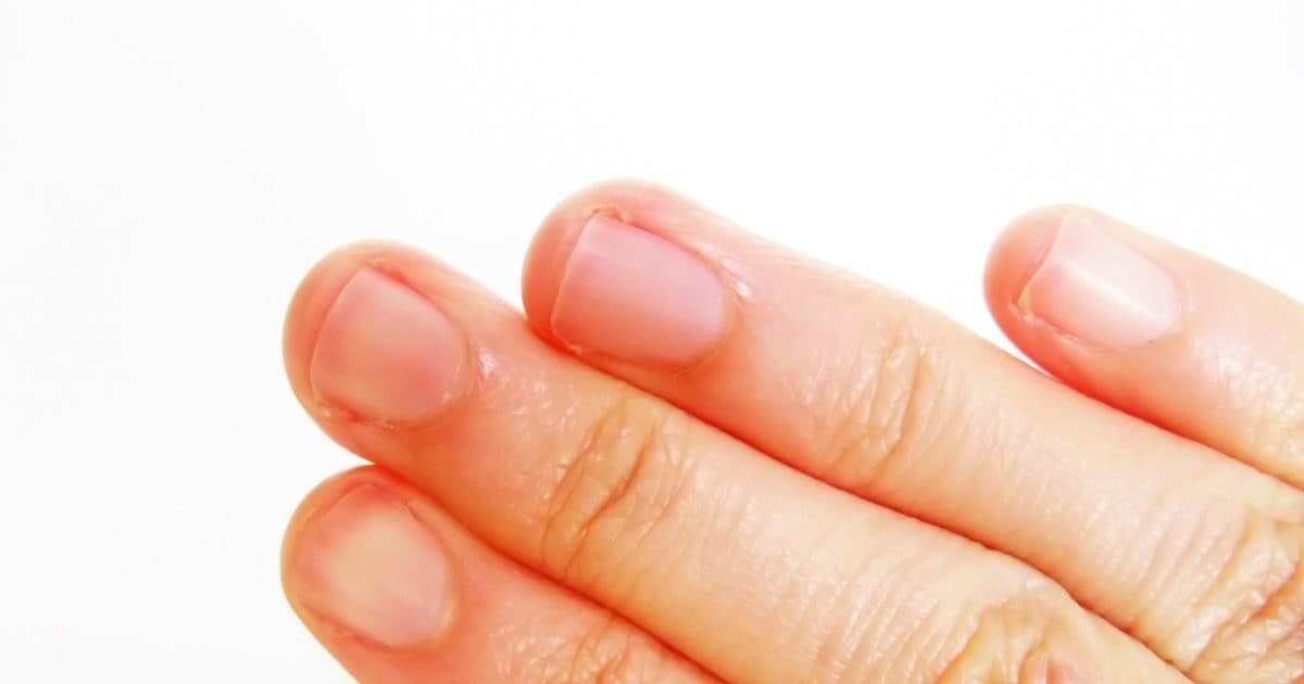 Fingertip Peeling फिंगरटिप पीलिंग के क्या हैं कारण, जानिए इसके होम