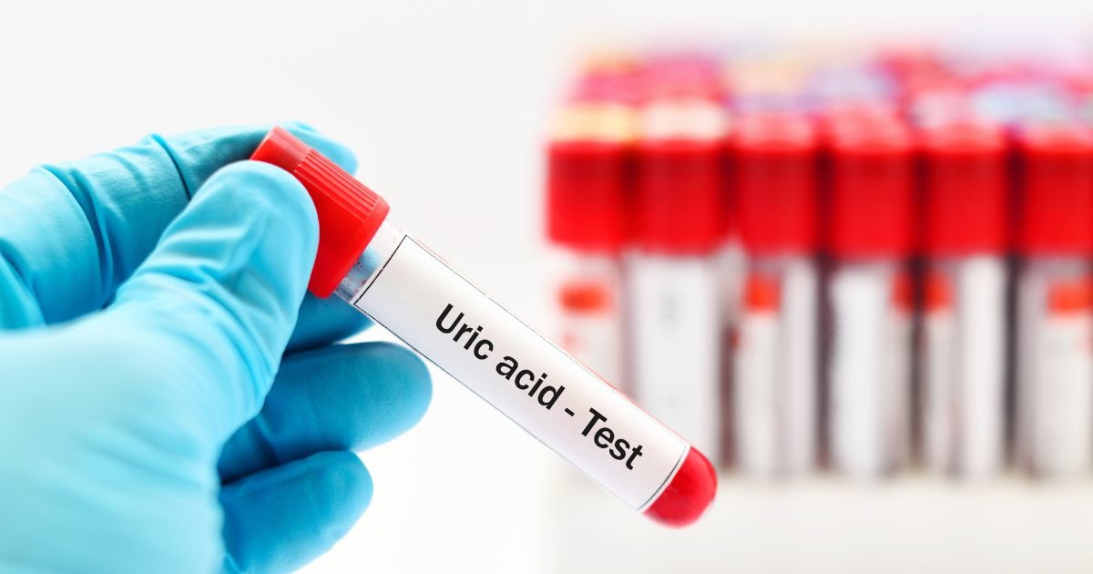 Water Intake In High Uric Acid यूरिक एसिड को कम कर सकता है पानी, जानें