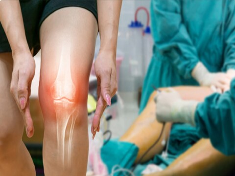घुटनों में दर्द होने या ऑस्टियोआर्थराइटिस के दर्द से निजात पाने के लिए एक्सरसाइज ही सबसे बेस्ट है. Image: Canva