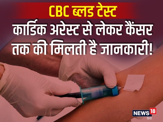 CBC Blood Test 200 
