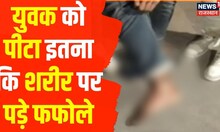 Nagaur News : युवक से थाने में मारपीट का आरोप, युवक के शरीर पर पड़े फफोले | Hindi News