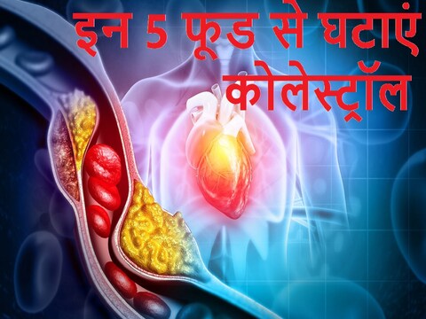 बादाम, अखरोट और अन्य ड्राई फ्रूट हार्ट को हेल्दी बनाते हैं. Image: Shutterstock