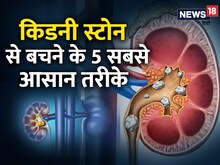 ज्यादा नमक खाने से हो सकता है किडनी स्टोन, इन तरीकों से कभी नहीं होगी समस्या