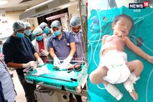 Medical Science Magic: करौली में डॉक्टरों ने असंभव को बनाया संभव, स्वस्थ हो गई 5 दिन की बच्ची- जानें मामला