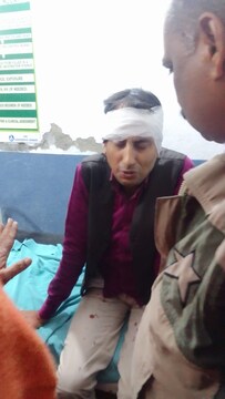 जख्मी सीएसपी संचालक का सामुदायिक स्वास्थ्य केंद्र संग्रामपुर में चल रहा है इलाज