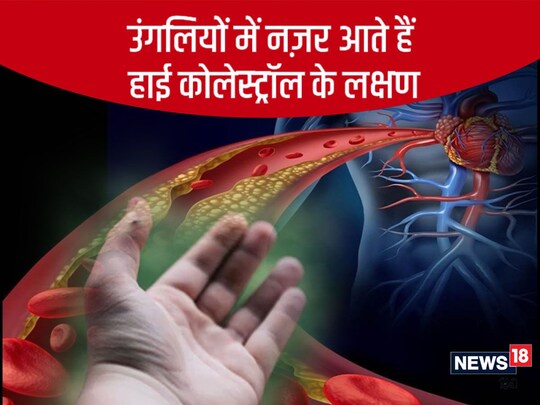कोलेस्ट्रॉल बढ़ने से कई गंभीर बीमारियों का खतरा पैदा हो जाता है. 