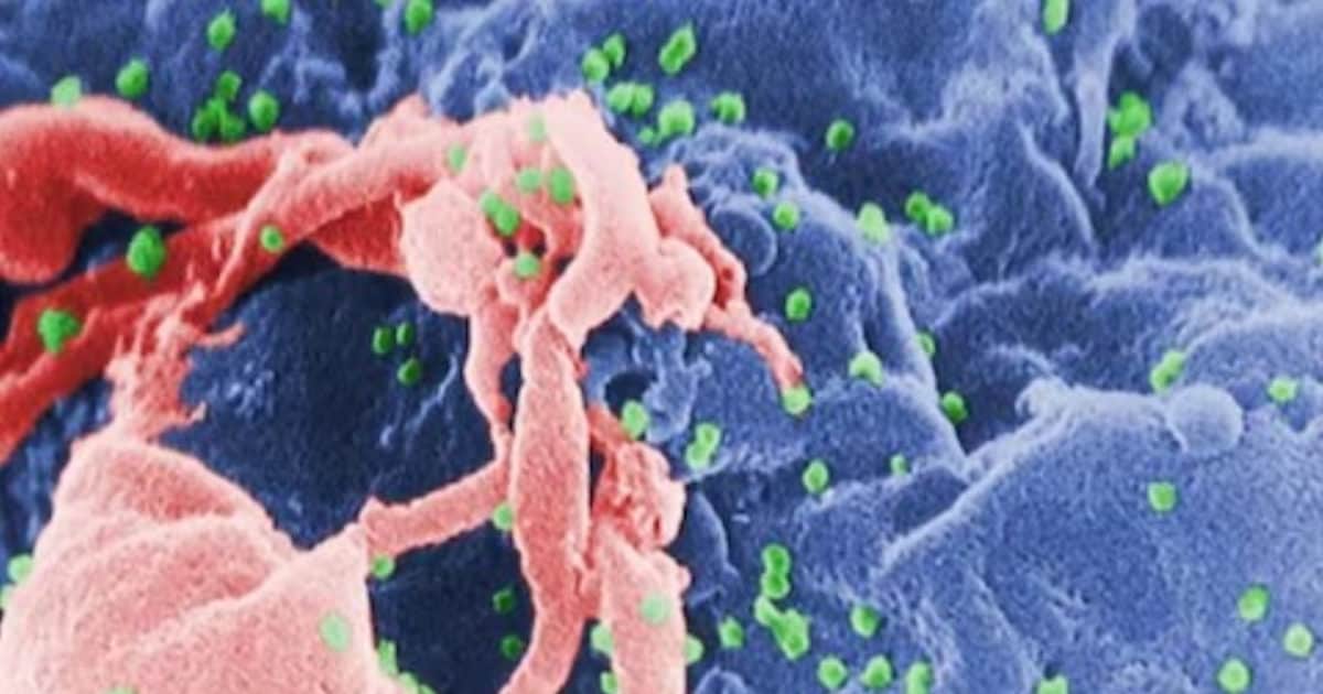 Hope  The person was in bad condition due to cancer and HIV, but won the battle with both the diseases.