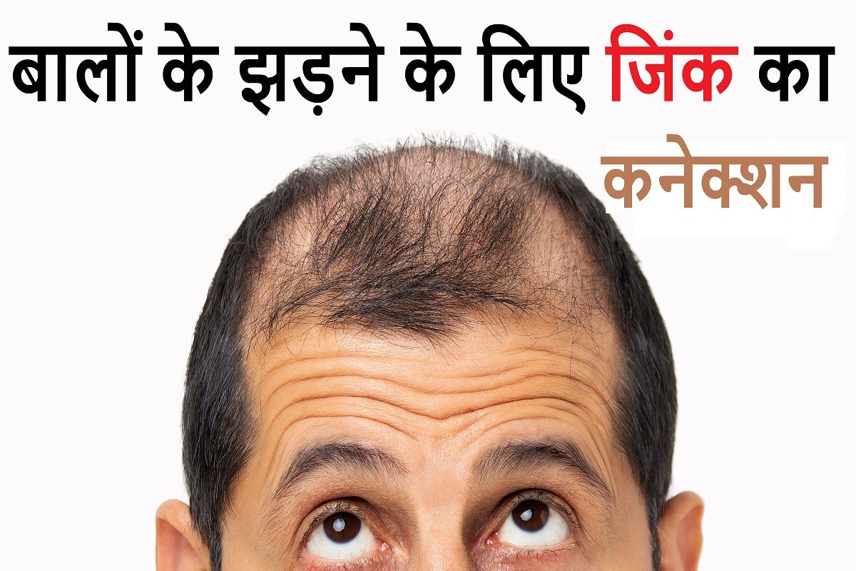 Hair Loss After Hysterectomy | Treatment and Causes – Equi Botanics