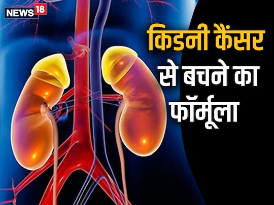 वहीं हाई ब्लड प्रेशर वाले लोगों को भी किडनी कैंसर का जोखिम रहता है.