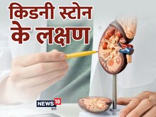 ये 5 संकेत शरीर में दिखें तो समझ जाइए किडनी में स्टोन हो गया, डॉक्टर से जानें