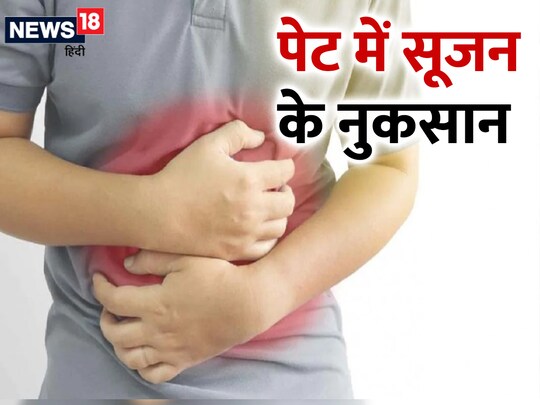 इरिटेबल बोवेल सिंड्रोम के कारण भी पेट में सूजन हो सकती है. 