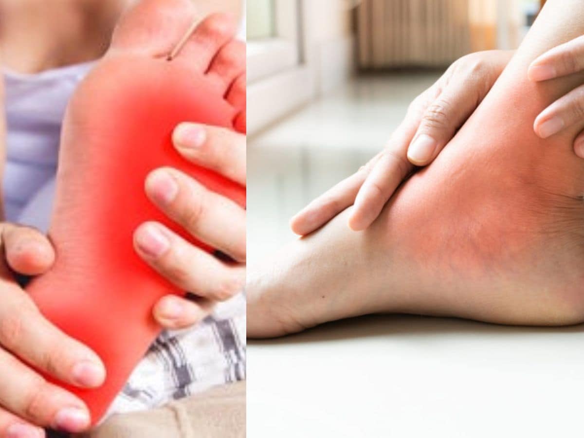 शरीर में इस चीज की कमी से तेजी से बढ़ने लगता है Uric Acid, समय रहते हो जाएं सावधान!