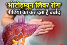 Autoimmune Liver Disease: This liver disease destroys generations, immediately go to the hospital as soon as these symptoms appear