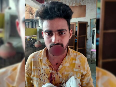 Meerut Crime News: रेप की कोशिश कर रहे मोहित का महिला ने काटा होंठ 