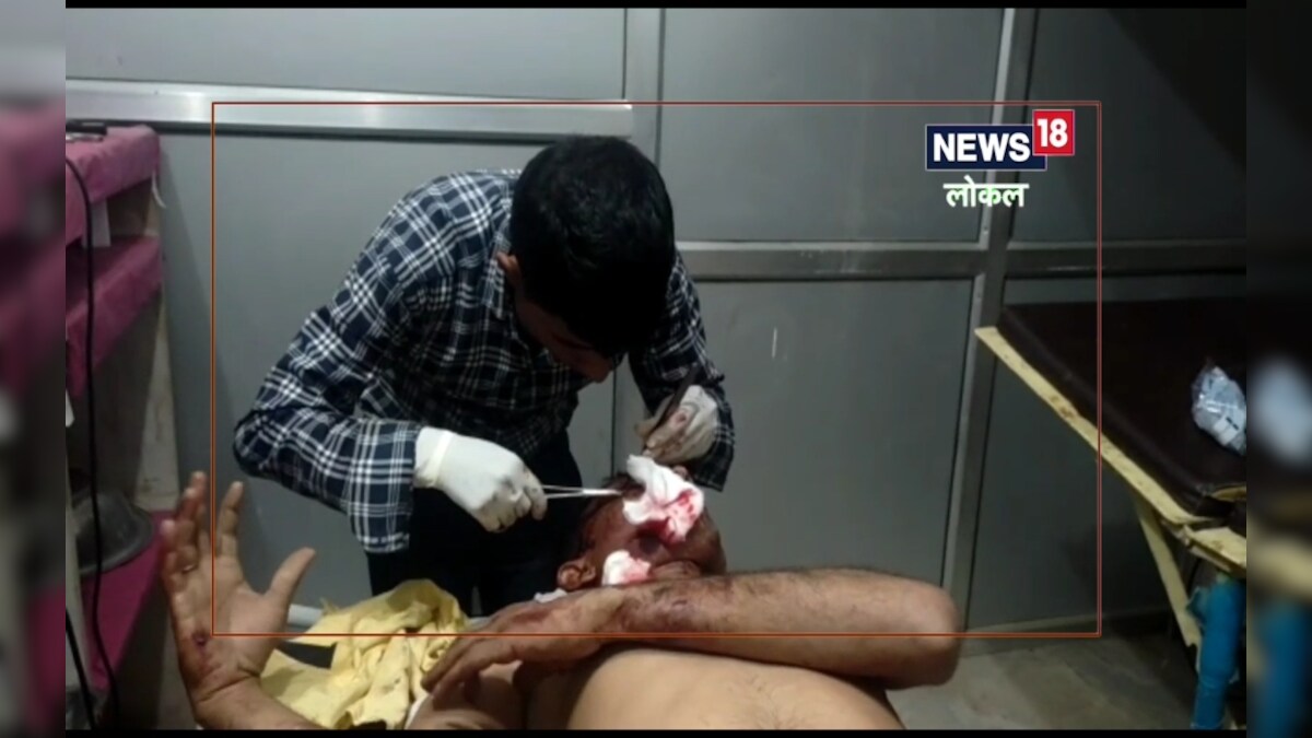 अमेठी में युवक पर दबंगों ने बरपाया कहर, धारदार हथियार से किया जानलेवा हमला; हालत गंभीर