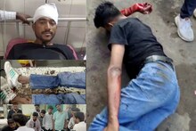 Jaisalmer Crime News: भीम आर्मी अध्यक्ष हरीश पर जानलेवा हमला, अपराधियों ने हाथ-पांव तोड़े