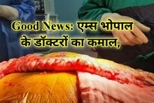 AIIMS Bhopal: डॉक्टरों ने किया कमाल, बना दी नई आहार नली, 10 महीने बाद मुंह से खा-पी सकी महिला