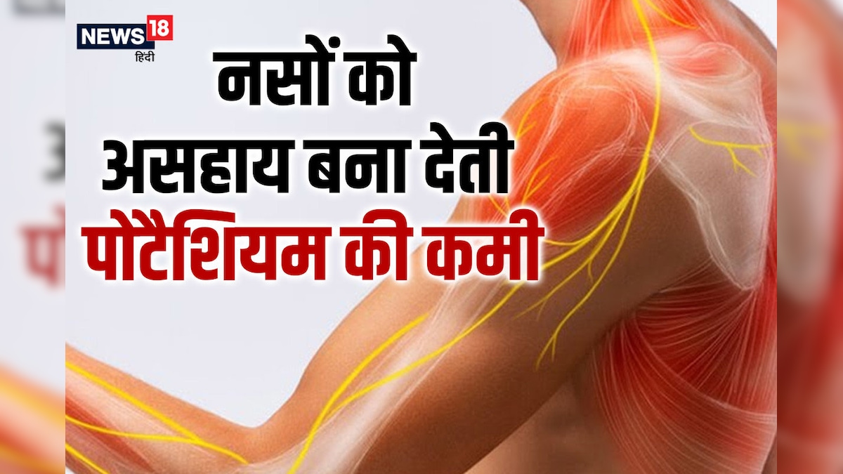 नसों को लुंज-पुंज बना देती है पोटैशियम की कमी, मसल्स में नहीं रह जाती है जान, कहीं आप भी तो नहीं हैं शिकार