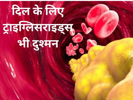 खून में ट्राइग्लिसराइड्स की ज्यादा मात्रा धमनियों को सख्त करने लगता है.