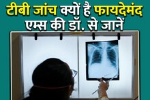 World TB Day: TB has come out in the test, don't be sad, be happy!  Dr. Urvashi of AIIMS said, these will be 3 big benefits 