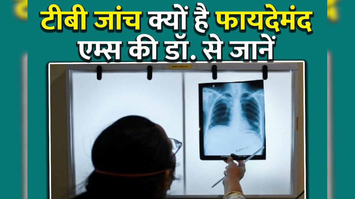 World TB Day: जांच में निकली है टीबी तो दुखी नहीं खुश होइए! एम्स की डॉ. उर्वशी बोलीं, होंगे ये 3 बड़े फायदे
