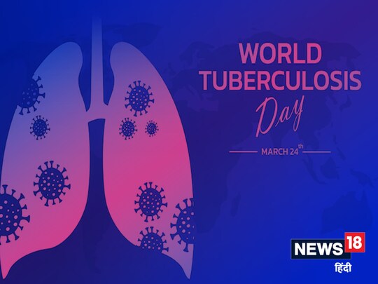 लंग्स के अलावा अन्य जगहों पर भी टीबी के बैक्टीरिया पहुंचने लगते हैं. 