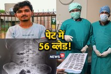 राजस्‍थान का आयरन मैन: युवक का पेट बना ब्‍लेड का गोदाम, एक-एक कर निगलीं 56 पत्तियां, 3 घंटे चली सर्जरी