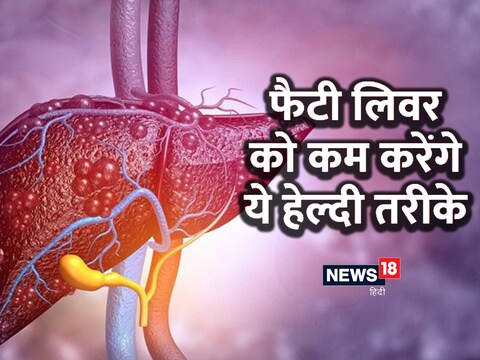 कॉफी का सेवन भी फैटी लीवर रोग को कम करने में असरदार हो सकता है. 