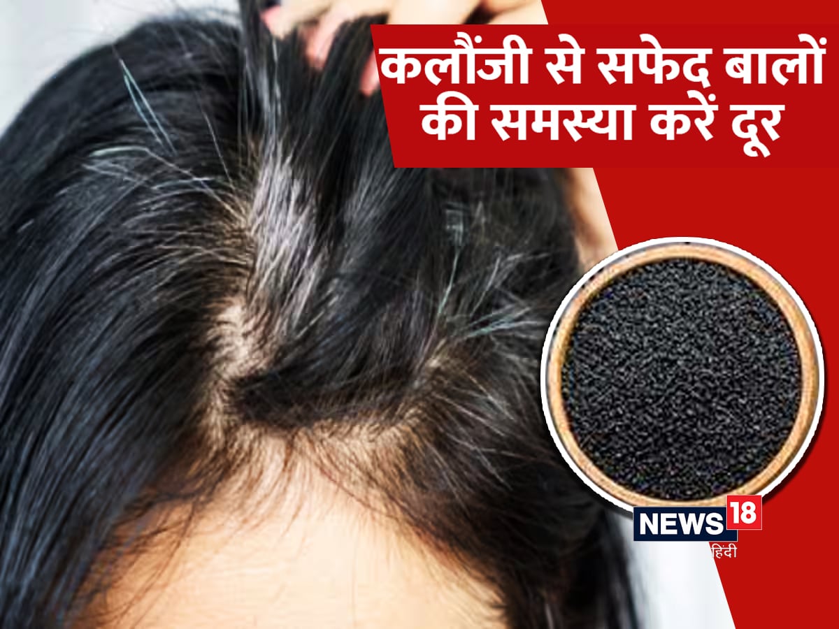 WishCare 100 Pure Cold Pressed Kalonji Black Onion Seed Oil for Healthy  Hair and Skin Buy WishCare 100 Pure Cold Pressed Kalonji Black Onion Seed  Oil for Healthy Hair and Skin Online