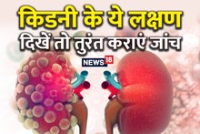 Stones are bad for kidney but these 3 diseases lead to dialysis, as soon as these signs appear, get kidney checked immediately