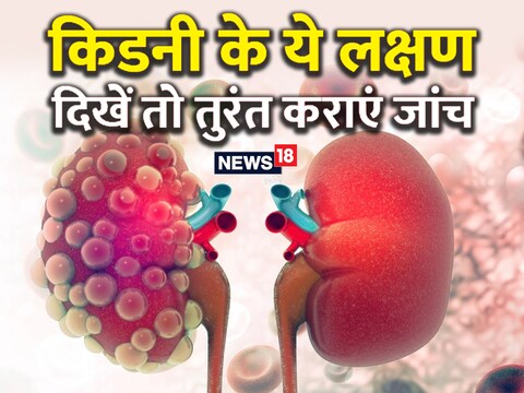 Kidney: किडनी हमारे शरीर में फिल्‍टर का काम करती हैं और गंदगी को बाहर निकालती हैं. 