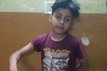 Ghaziabad: घर के बाहर खेल रहे 9 साल के बच्चे पर पिटबुल ने किया हमला, हाथ-पैर और कमर पर काटा