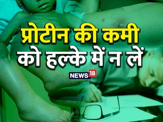 प्रोटीन की कमी से मानसिक स्वास्थ्य पर बुरा असर पड़ता है.