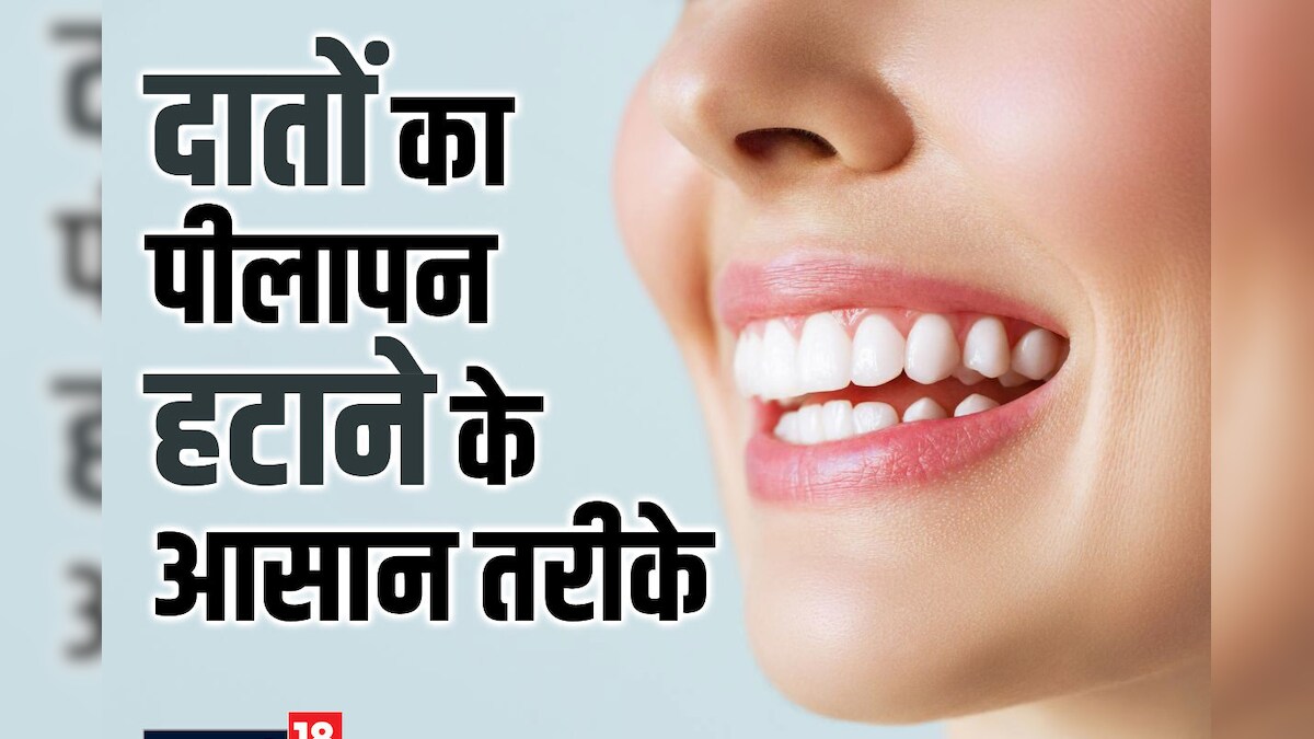 Teeth Cleaning Tips: पीले दांतों को आसानी से बनाएं सफेद, अपनाएं ये 5 आसान घरेलू नुस्खे, चमक उठेंगे दांत