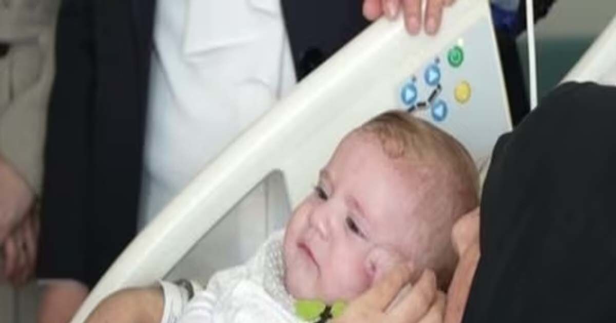 Turkey Earthquake This child came out of the debris after 5 days, now