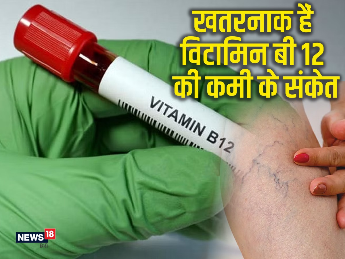 vitamin b12 injection benefits in hindi Zecobax-12 Injection in Hindi की जानकारी, लाभ, फायदे, उपयोग, कीमत, खुराक,  नुकसान, साइड इफेक्ट्स
