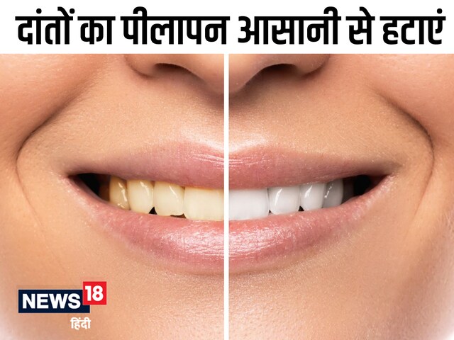 नींबू के साथ इस चीज को मिलाकर दांतों में लगाएं, दिखेगी दूध सी सफेदी