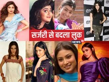 शिल्पा शेट्टी से अनुष्का शर्मा तक, 6 एक्ट्रेसेज करा चुकी हैं सर्जरी....