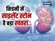 किडनी में साइलेंट पड़ी पथरी कर सकती है गुर्दा फेल, लगेंगे बस कुछ महीने